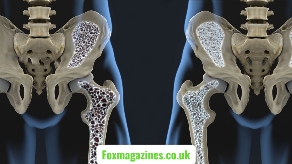 Osteopur Supplement: Natural Bone Support, Benefits, Ingredients, and Wellness osteopur