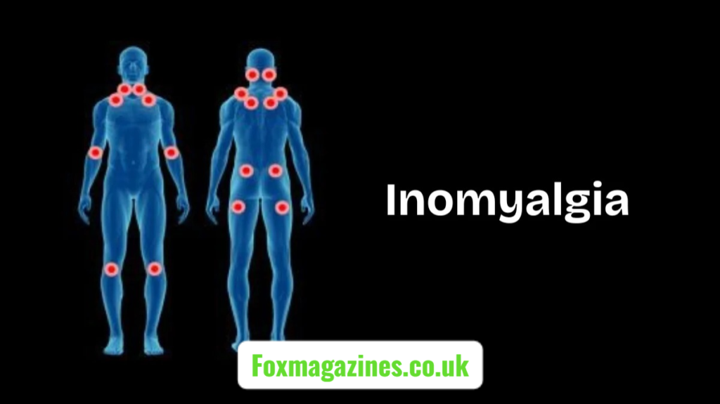 inomyalgia